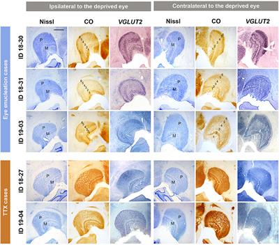 The Expression Patterns of Cytochrome Oxidase and Immediate-Early Genes Show Absence of Ocular Dominance Columns in the Striate Cortex of <mark class="highlighted">Squirrel</mark> Monkeys Following Monocular Inactivation